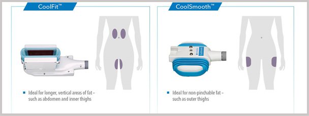 Aprender sobre el Coolfit y CoolSmooth para los muslos exteriores e interiores